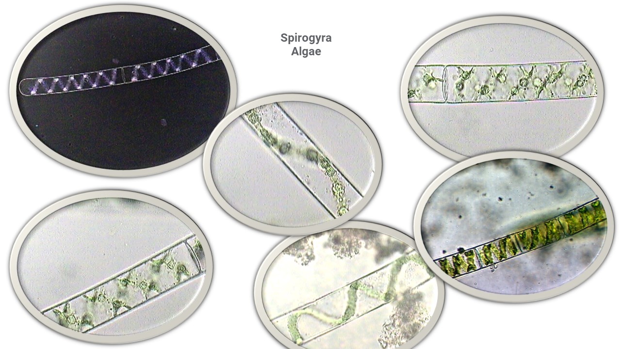 Spirogyra