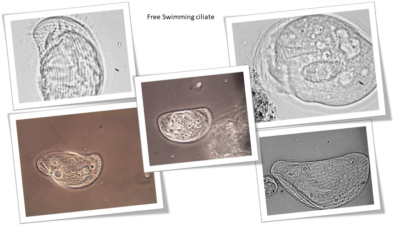 Free swimming ciliates