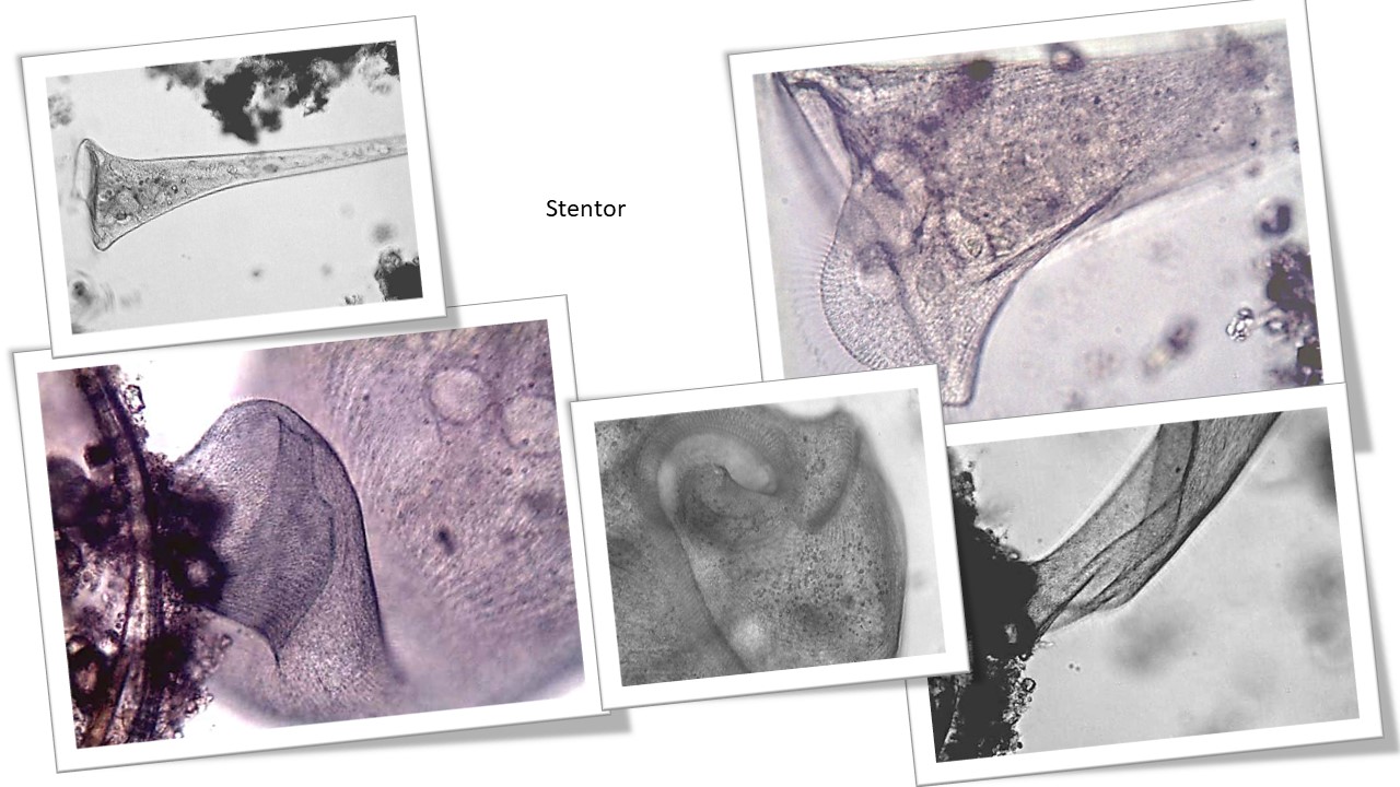 Stentor stalked ciliates