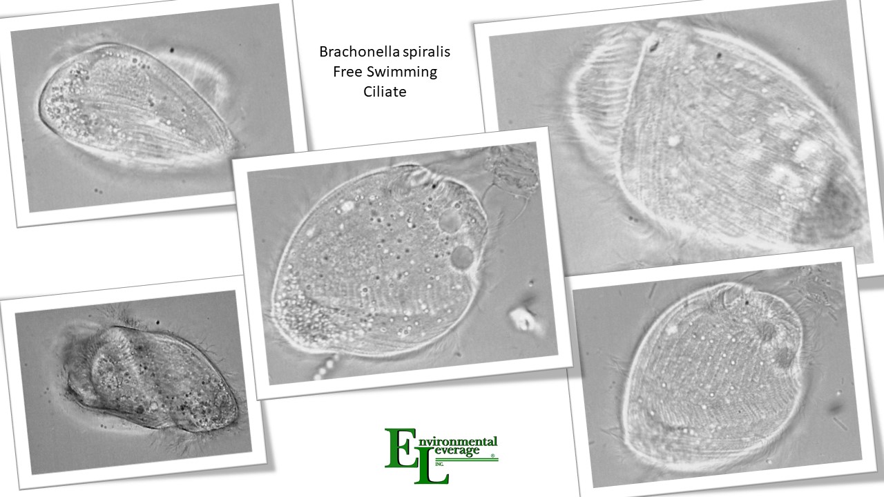 brachonella spiralis free swimming ciliate