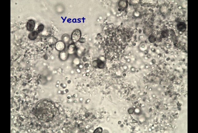 yeast