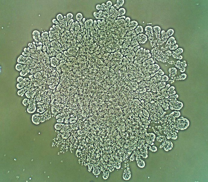 Zooglea in wastewater bioimass analyses