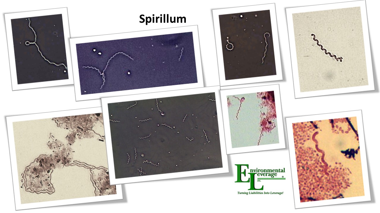 Spirillum septicity in wastewater