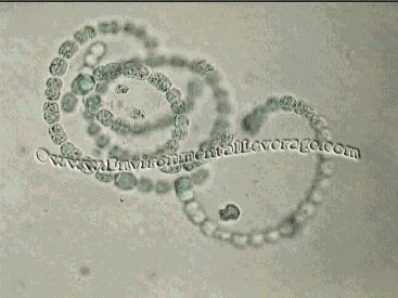 anabaena