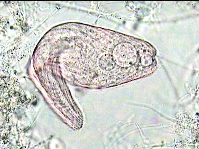 Blepharisma