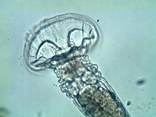 rotifer