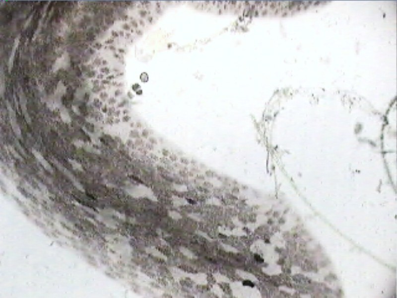 planaria