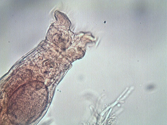 rotifer