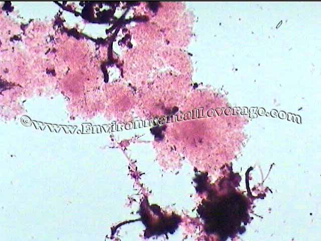 1000x gram stain