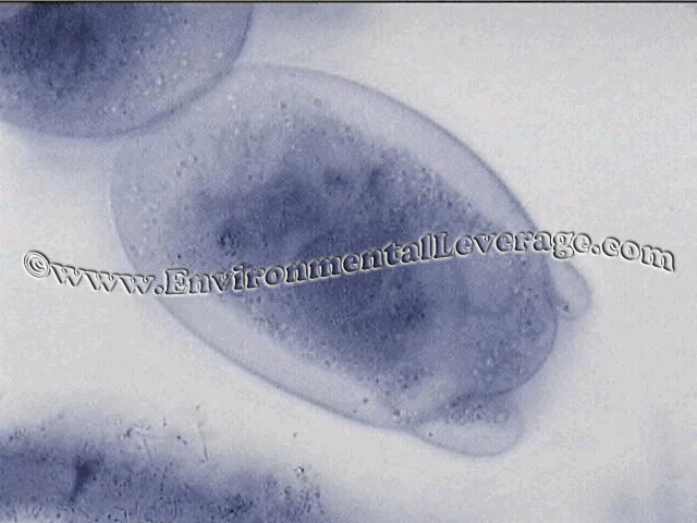 Latophenol cotton blue stain