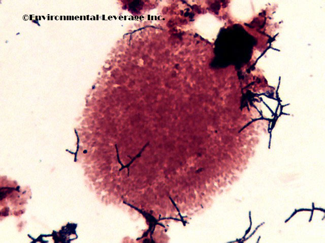 Zooglea and Nocardia