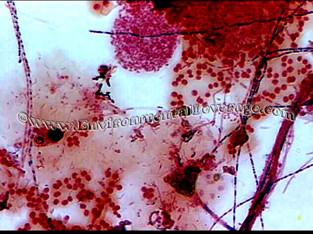 gram stain