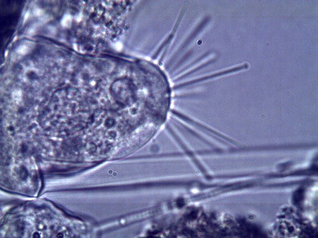 Stalked ciliates