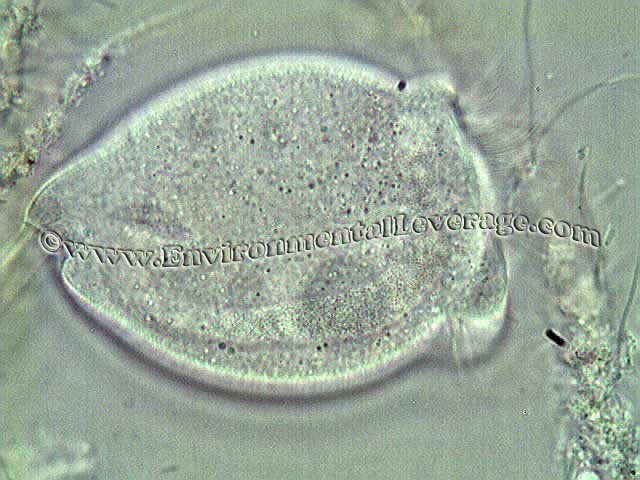 stalked ciliate