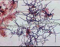 Environmental Leverage Filaments