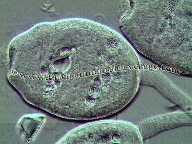 stalked ciliate 1000x, Plant Operations Seminar, wastewater training, operators training