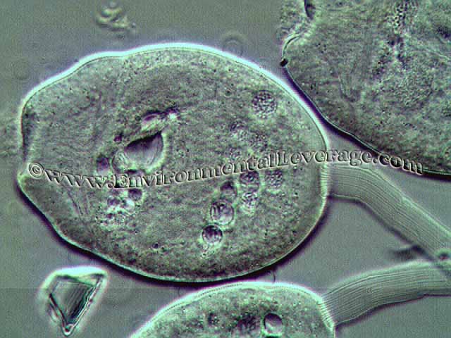 stalked ciliate 1000x, Plant Operations Seminar, wastewater training, operators training